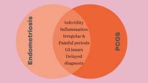 Endometriosis vs PCOS overlapping symptoms