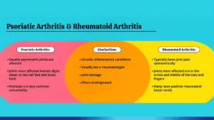 psoriatic arthritis vs rheumatoid arthritis