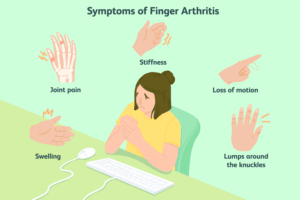 symptoms of arthritis in hands