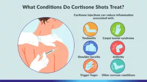 treatment for joint pain and stiffness - corticosteriod shots