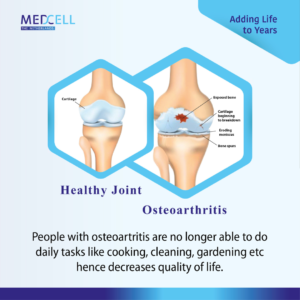 what is arthritis - osteoarthritis vs normal joint